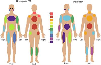 Spinal Cord Resting State Activity in Individuals With Fibromyalgia Who Take Opioids